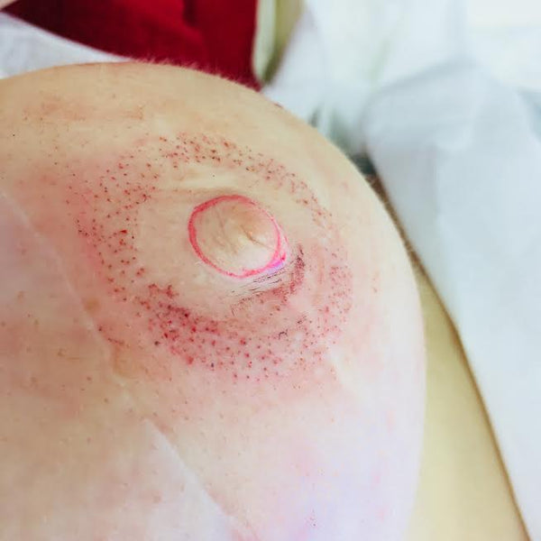 After Having A Lumpectomy, This Breast Cancer Survivor Chose A Stunning  Tattoo Instead Of Nipple Reconstruction